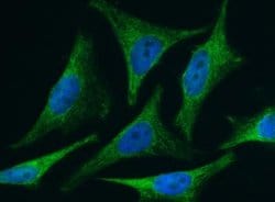 BID Rabbit anti-Human, Clone: 5, Novus Biologicals:Antibodies:Primary Antibodies