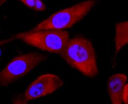 BID Rabbit anti-Human, Clone: JM11-14, Novus Biologicals 100&mu;L:Antibodies,