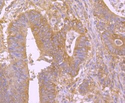 BID Rabbit anti-Human, Clone: JM11-14, Novus Biologicals 100&mu;L:Antibodies,