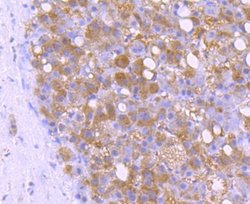 BID Rabbit anti-Human, Clone: JM11-14, Novus Biologicals 100&mu;L:Antibodies,