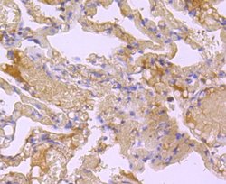 BID Rabbit anti-Human, Clone: JM11-14, Novus Biologicals 100&mu;L:Antibodies,