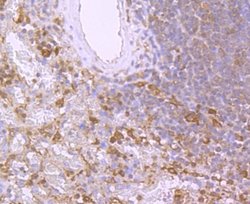 BID Rabbit anti-Human, Clone: JM11-14, Novus Biologicals 100&mu;L:Antibodies,