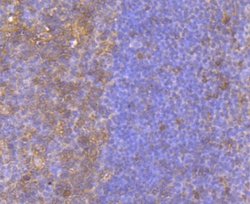 BID Rabbit anti-Human, Clone: JM11-14, Novus Biologicals 100&mu;L:Antibodies,