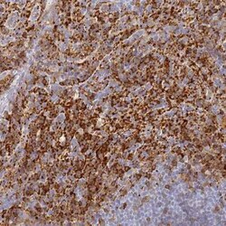 BIN2 Antibody, Novus Biologicals 25 &mu;L, Unconjugated:Antibodies, Polyclonal