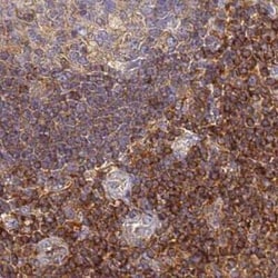 BIN2 Antibody, Novus Biologicals:Antibodies:Primary Antibodies