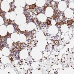 BIN2 Antibody, Novus Biologicals 25 &mu;L, Unconjugated:Antibodies, Polyclonal