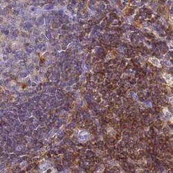 BIN2 Antibody, Novus Biologicals 25 &mu;L, Unconjugated:Antibodies, Polyclonal