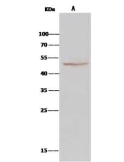 BLMH/Bleomycin Hydrolase Antibody, Novus Biologicals 50 &mu;g; Unconjugated:Antibodies,