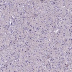 BLNK Antibody, Novus Biologicals 25 &mu;L; Unconjugated:Antibodies, Polyclonal