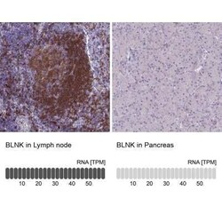 BLNK Antibody, Novus Biologicals 25 &mu;L; Unconjugated:Antibodies, Polyclonal