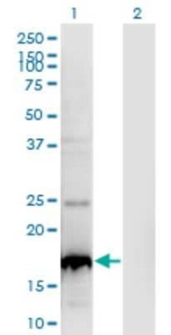 BLOC1S2 Antibody (8C10), Novus Biologicals 0.1 mg | Buy Online | Novus Biologicals | Fisher Scientific