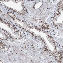 BMI-1 Antibody, Novus Biologicals 0.1 mL | Buy Online | Novus Biologicals | Fisher Scientific