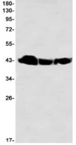 BMI-1 Antibody (S08-7A6), Novus Biologicals 50 &mu;g | Buy Online | Novus Biologicals | Fisher Scientific