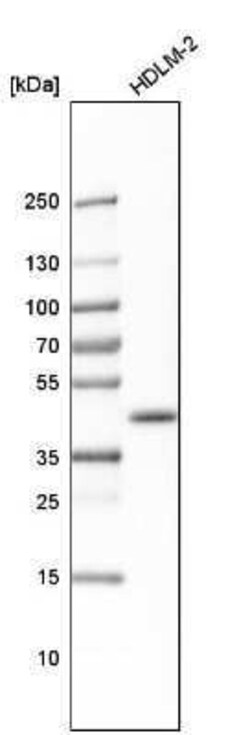BMI-1 Antibody, Novus Biologicals 0.1 mL | Buy Online | Novus Biologicals | Fisher Scientific