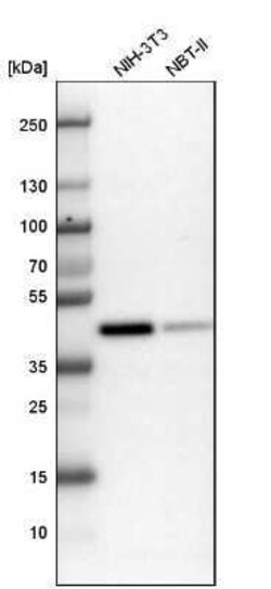 BMI-1 Antibody, Novus Biologicals 0.1 mL | Buy Online | Novus Biologicals | Fisher Scientific