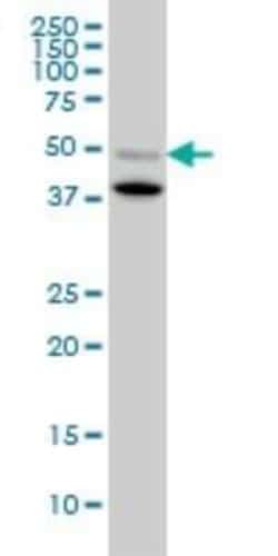 Novus Biologicals BMP-7 Antibody (S52), Novus Biologicals 0.1 mg | Buy Online | Novus Biologicals&trade; | Fisher Scientific