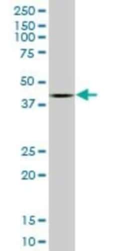 Novus Biologicals BMP-7 Antibody (S52), Novus Biologicals 0.1 mg | Buy Online | Novus Biologicals&trade; | Fisher Scientific
