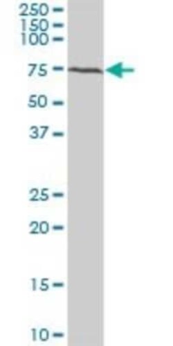 BMPR-IB/ALK-6 Antibody (2E2), Novus Biologicals 0.1 mg | Buy Online | Novus Biologicals | Fisher Scientific