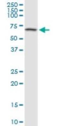 BMPR-IB/ALK-6 Antibody (2E2), Novus Biologicals 0.1 mg | Buy Online | Novus Biologicals | Fisher Scientific