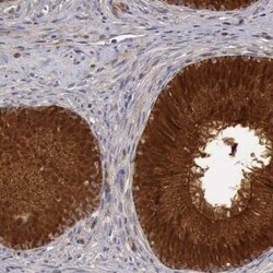 BMX Antibody, Novus Biologicals 25 &mu;L; Unconjugated:Antibodies, Polyclonal