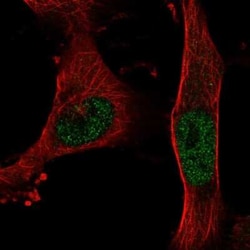 BNC2 Antibody, Novus Biologicals:Antibodies:Primary Antibodies