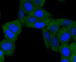 BNIP3 Rabbit anti-Human, Clone: JA71-10, Novus Biologicals 100&mu;L:Antibodies,