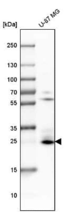 BNIP3 Antibody, Novus Biologicals 0.1 mL | Buy Online | Novus Biologicals | Fisher Scientific