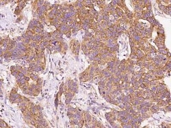 BNIP3L Antibody, Novus Biologicals 50 &mu;g; Unconjugated:Anticuerpos