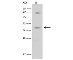 BNIP3L Antibody, Novus Biologicals 50 &mu;g; Unconjugated:Anticuerpos