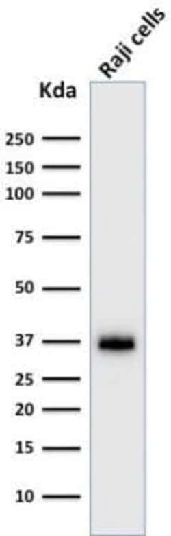 BOB1 Mouse anti-Human, Clone: BOB1/2422, Novus Biologicals 100 &mu;g; Unconjugated:Antibodies,