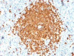 BOB1 Antibody (BOB1/2424), Novus Biologicals:Anticuerpos:Anticuerpos primarios