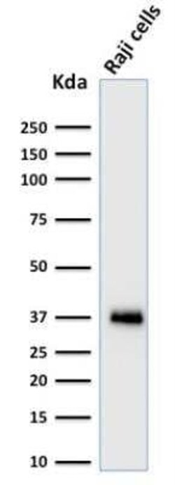 BOB1 Antibody (BOB1/2424), Novus Biologicals:Anticuerpos:Anticuerpos primarios