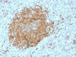 BOB1 Antibody (BOB1/2425), Novus Biologicals:Antibodies:Primary Antibodies