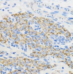 BOLA3 Antibody - Azide and BSA Free, Novus Biologicals:Antibodies:Primary