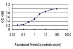 BP1 Antibody (1F11), Novus Biologicals 0.1 mg | Buy Online | Novus Biologicals | Fisher Scientific