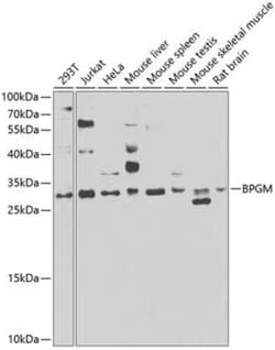 BPGM Antibody - BSA Free, Novus Biologicals:Antibodies:Primary Antibodies