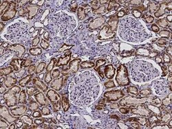 BPHL Antibody, Novus Biologicals 50 &mu;g; Unconjugated:Antibodies, Polyclonal