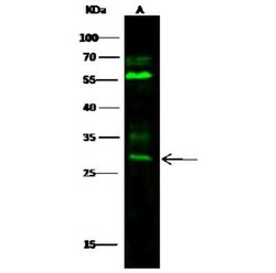 BPHL Antibody, Novus Biologicals 50 &mu;g; Unconjugated:Antibodies, Polyclonal