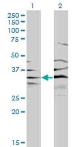 BPNT1 Antibody (2E1), Novus Biologicals 0.1 mg | Buy Online | Novus Biologicals | Fisher Scientific