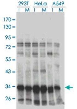 BRAF35 Antibody (1F6), Novus Biologicals 0.1 mg | Buy Online | Novus Biologicals | Fisher Scientific