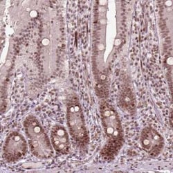 BRAF35 Antibody, Novus Biologicals 25 &mu;L, Unconjugated:Antibodies, Polyclonal