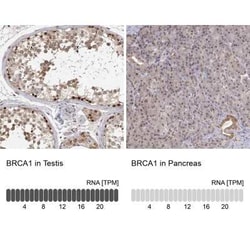 BRCA1 Antibody, Novus Biologicals 25ul; Unconjugated:Antibodies, Polyclonal