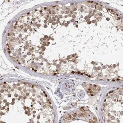 BRCA1 Antibody, Novus Biologicals 25ul; Unconjugated:Antibodies, Polyclonal