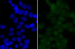 BRD2 Antibody (JG40-42), Novus Biologicals 100 &mu;L | Buy Online | Novus Biologicals | Fisher Scientific