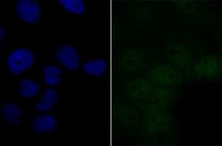BRD2 Antibody (JG40-42), Novus Biologicals 100 &mu;L | Buy Online | Novus Biologicals | Fisher Scientific