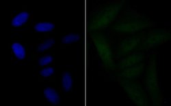 BRD2 Antibody (JG40-42), Novus Biologicals 100 &mu;L | Buy Online | Novus Biologicals | Fisher Scientific