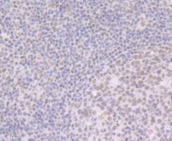 BRD2 Antibody (JG40-42), Novus Biologicals 100 &mu;L | Buy Online | Novus Biologicals | Fisher Scientific