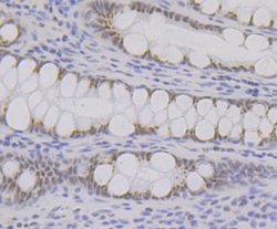 BRD2 Antibody (JG40-42), Novus Biologicals 100 &mu;L | Buy Online | Novus Biologicals | Fisher Scientific
