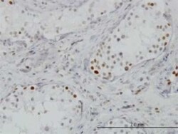 BRD3 Antibody (7G6), Novus Biologicals 0.1 mg, Unconjugated:Antibodies,