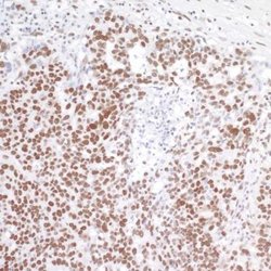 BRD4 Antibody (BL-149-2H5), Novus Biologicals 100 &mu;L; Unconjugated:Antibodies,